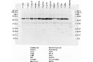 Image no. 3 for anti-Calreticulin (CALR) antibody (HRP) (ABIN2486726)