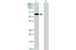 Image no. 1 for anti-IKAROS Family Zinc Finger 5 (Pegasus) (IKZF5) (AA 1-420) antibody (ABIN528619)