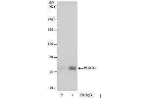 Image no. 2 for anti-6-phosphofructo-2-Kinase/fructose-2,6-Biphosphatase 3 (PFKFB3) (C-Term) antibody (ABIN2856593)