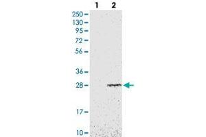 Image no. 2 for anti-Emopamil Binding Protein (Sterol Isomerase) (EBP) antibody (ABIN5576966)