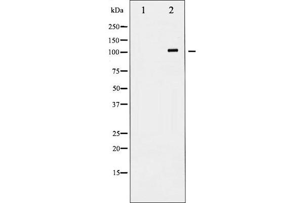 GRIN1/NMDAR1 Antikörper  (C-Term)