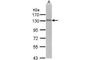Image no. 3 for anti-Ubiquitin Specific Peptidase 15 (USP15) (C-Term) antibody (ABIN2855881)