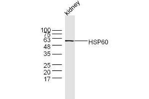 Image no. 3 for anti-Heat Shock 60kDa Protein 1 (Chaperonin) (HSPD1) (AA 501-573) antibody (ABIN726080)
