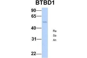 Image no. 2 for anti-BTB (POZ) Domain Containing 1 (BTBD1) (N-Term) antibody (ABIN2775819)