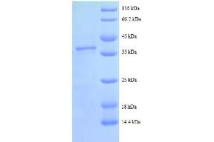 Image no. 1 for Secretory Leukocyte Peptidase Inhibitor (SLPI) (AA 26-132), (full length) protein (GST tag) (ABIN1046564)