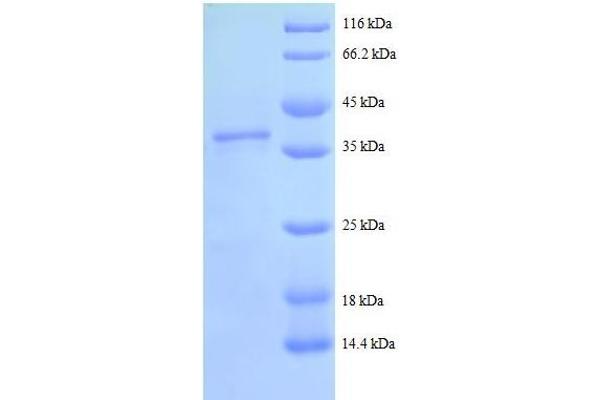 Secretory Leukocyte Peptidase Inhibitor (SLPI) (AA 26-132), (full length) protein (GST tag)