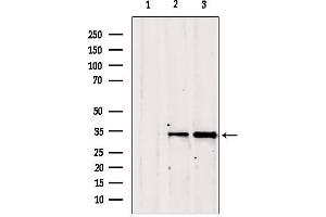 Image no. 3 for anti-Golgi phosphoprotein 3 (Coat-Protein) (GOLPH3) (C-Term) antibody (ABIN6262030)