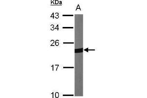 Image no. 1 for anti-Periaxin (PRX) (Center) antibody (ABIN2855135)