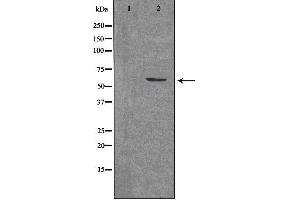 Image no. 1 for anti-Aristaless Related Homeobox (ARX) (Internal Region) antibody (ABIN6257677)