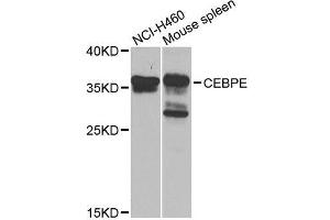Image no. 1 for anti-CCAAT/enhancer Binding Protein (C/EBP), epsilon (CEBPE) antibody (ABIN6138385)