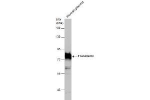 Image no. 4 for anti-Transferrin (TF) (Center) antibody (ABIN2854907)