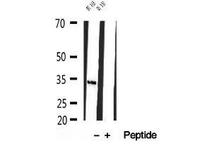 Image no. 2 for anti-Ha-Ry/enhancer-of-Split Related with YRPW Motif 1 (HEY1) (Internal Region) antibody (ABIN6262226)