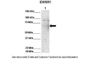 Image no. 2 for anti-Ewing Sarcoma Breakpoint Region 1 (EWSR1) (Middle Region) antibody (ABIN2780666)
