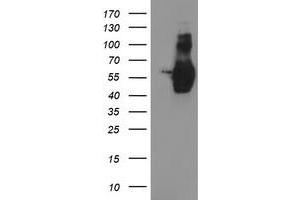 Image no. 4 for anti-Golgi Membrane Protein 1 (GOLM1) antibody (ABIN1498491)