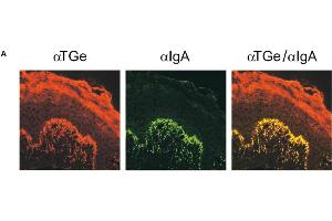 Image no. 1 for anti-Transglutaminase 3 (E Polypeptide, Protein-Glutamine-gamma-Glutamyltransferase) (TGM3) antibody (ABIN110114)