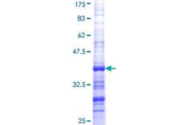PHTF1 Protein (AA 248-347) (GST tag)