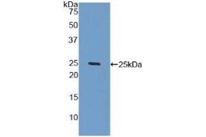 GLB1 anticorps  (AA 68-219)