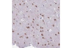Image no. 1 for anti-Neuro-Oncological Ventral Antigen 2 (NOVA2) antibody (ABIN5584642)
