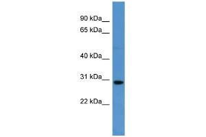 Image no. 2 for anti-Sprouty-Related, EVH1 Domain Containing 2 (SPRED2) (C-Term) antibody (ABIN2788425)