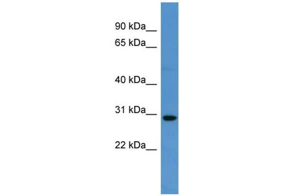 SPRED2 Antikörper  (C-Term)