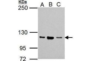 WB Image Sample (30 ug of whole cell lysate) A: Jurkat B: Raji C: K562 5% SDS PAGE antibody diluted at 1:1000