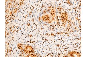 Image no. 4 for anti-Jun Proto-Oncogene (JUN) (pSer243) antibody (ABIN6255121)