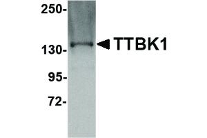 Image no. 1 for anti-tau Tubulin Kinase 1 (Ttbk1) (C-Term) antibody (ABIN6655918)