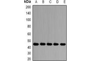 Image no. 3 for anti-Proteasome (Prosome, Macropain) 26S Subunit, Non-ATPase, 13 (PSMD13) antibody (ABIN3198277)