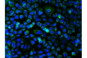 Image no. 3 for anti-Mast/stem Cell Growth Factor Receptor (KIT) (AA 350-440) antibody (ABIN1387260)