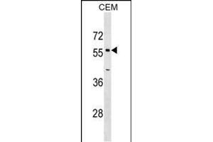 OPTN Antibody (Center) (ABIN1538582 and ABIN2849499) western blot analysis in CEM cell line lysates (35 μg/lane).