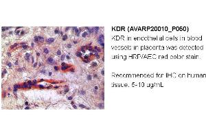 Image no. 1 for anti-VEGF Receptor 2 (VEGFR2) (N-Term) antibody (ABIN2792307)