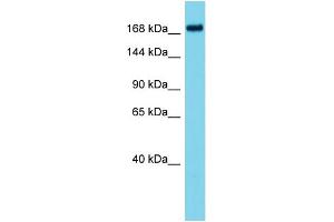 Image no. 1 for anti-ATPase Family, AAA Domain Containing 2B (ATAD2B) (N-Term) antibody (ABIN2790911)