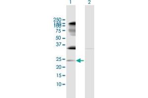 Image no. 3 for anti-Interleukin 32 (IL32) (AA 1-188) antibody (ABIN522698)