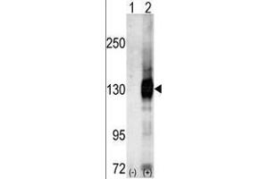 Image no. 2 for anti-Calcium/calmodulin-Dependent serine Protein Kinase (MAGUK Family) (CASK) (C-Term) antibody (ABIN359407)