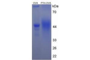 Image no. 2 for Parathyroid Hormone (PTH) peptide (Ovalbumin) (ABIN5666323)