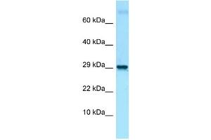 Image no. 1 for anti-LIM Domain Only 2 (Rhombotin-Like 1) (LMO2) (C-Term) antibody (ABIN2780690)