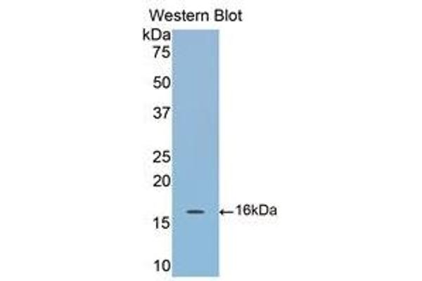 anti-Cartilage Oligomeric Matrix Protein (COMP) (AA 40-180) antibody