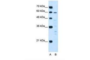 Image no. 1 for anti-Interleukin 10 Receptor, alpha (IL10RA) (AA 128-177) antibody (ABIN320912)