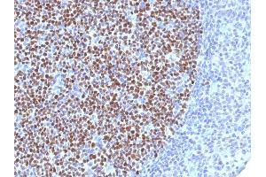 Image no. 5 for anti-B-Cell CLL/lymphoma 6 (BCL6) (AA 256-389) antibody (ABIN6940529)