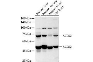 ACOX1 抗体  (AA 1-270)