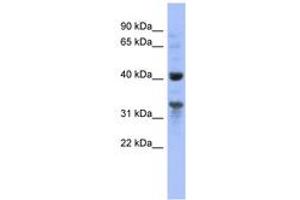 Image no. 1 for anti-Mitochondrial Ribosomal Protein L37 (MRPL37) (AA 35-84) antibody (ABIN6741668)
