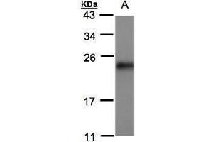 WB Image Sample(30 μg of whole cell lysate) A:MOLT4, 15% SDS PAGE antibody diluted at 1:500