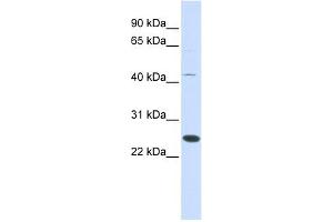 Image no. 1 for anti-Family With Sequence Similarity 119A (FAM119A) (Middle Region) antibody (ABIN631721)