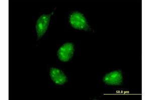 Image no. 2 for anti-MYC Associated Factor X (MAX) (AA 1-151) antibody (ABIN561745)