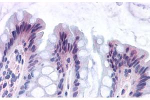 Image no. 1 for anti-G Protein-Coupled Receptor 82 (GPR82) (Cytoplasmic Domain) antibody (ABIN1048877)