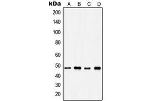 Image no. 3 for anti-Inositol Hexakisphosphate Kinase 2 (IP6K2) (Center) antibody (ABIN2706404)