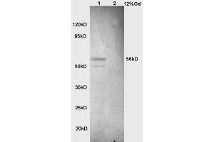Image no. 6 for anti-Alkaline Phosphatase, Liver/bone/kidney (ALPL) (AA 52-150) antibody (ABIN730988)