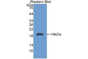 IL1RN Antikörper  (AA 26-177)
