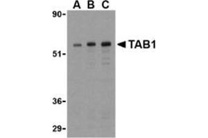 Image no. 2 for anti-TGF-beta Activated Kinase 1/MAP3K7 Binding Protein 1 (TAB1) (Center) antibody (ABIN500859)