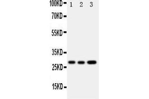 anti-Oncostatin M (OSM) (AA 181-198), (Middle Region) antibody